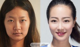 成都6d明星眼靠谱吗,真实效果还是炒作？