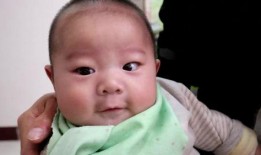 婴儿青光眼图片,婴儿青光眼早期症状与诊断要点揭秘