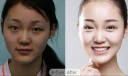 成都6d明星眼靠谱吗,真实效果还是炒作？